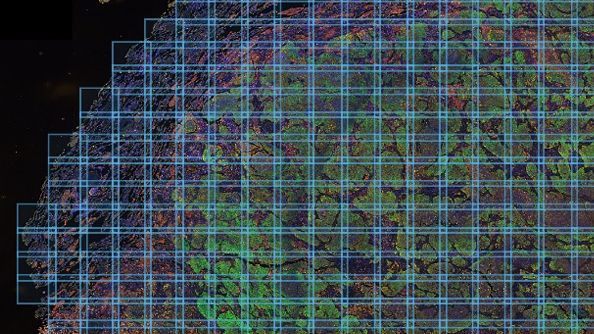A screencapture of a tumor microenvironment in cellview. A magnified cell has florescent pink and green superimpositions and is sectioned with a cyan grid